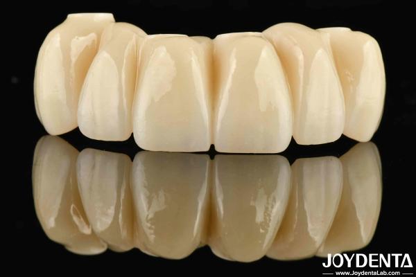 Buy cheap Dental Restoration Ti-Base Zirconia Hybrid Bridge Natural Looking Precise Fit from wholesalers
