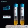 Buy cheap Relieve Pain PRP Test Tube 20ml ACD-A With GEL For OA Treatment from wholesalers