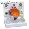 Buy cheap Glaucoma Model Plastic Eyes Models Eye Diseases Model Cataract Eye Model from wholesalers
