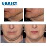 Buy cheap New arrival peface 3 handle emslim rf facial lifting wrinkles remover from wholesalers