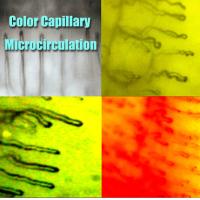Buy cheap Hospital Nailfold Capillary Microscopy / Microcirculation Microscope Multi product