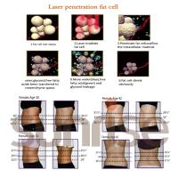 Buy cheap Beijing sunrise 940nm weight loss body slimming machine 650nm lipo laser product