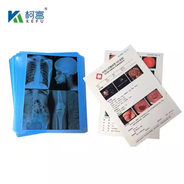 Buy cheap Medical Laser Film With High Color Accuracy And Fidelity 14x18in 0.16mm For True - To - Life Diagnostic Images from wholesalers