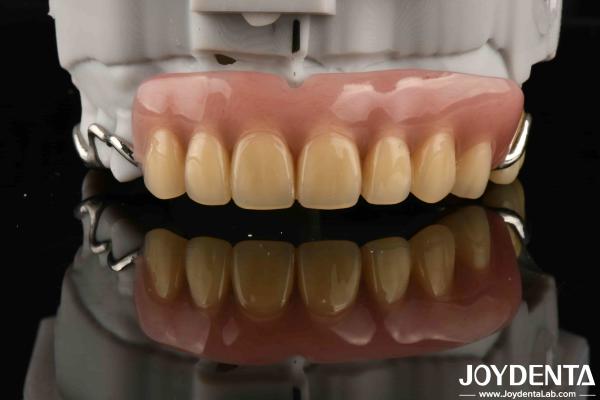 Buy cheap Elaborate Dental Stable Oral Structure Framework Set Up Teeth Finish For Optimal Oral Health from wholesalers