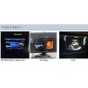 Buy cheap 2D 3D 4D Echocardiography Cardiac Trolley Echo Color Doppler Ultrasound Machine from wholesalers