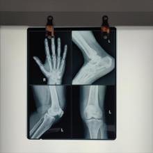 Buy cheap Low Fog Level Medical X Ray Blue Film 200±5μM High Sharpness from wholesalers