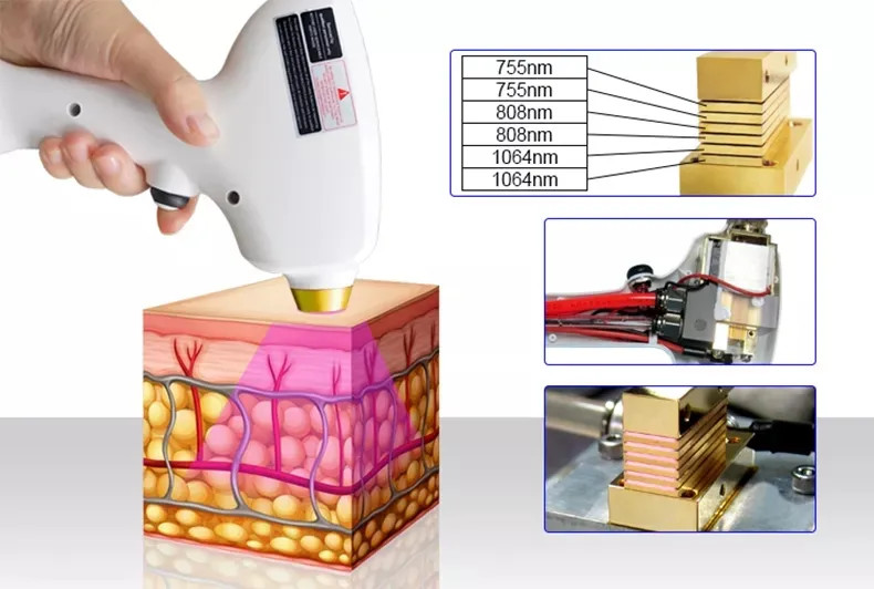 10.4 Inch Diode Laser Hair Removal Machine 808nm Skin Rejuvenation Beauty Device
