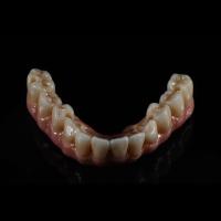 Buy cheap Fixed Restorations Full Arch Zirconia Implant Bridge Denture Teeth product