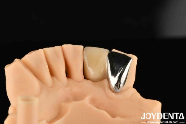 Dental Metal / Maryland Bridege Oral Clinical Repair Metallic Ideal Color
