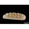 Buy cheap Wear Resistant Zirconia Full Contour Dental Crown High Translucency from wholesalers