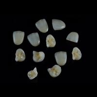 Buy cheap Dental Restorations IPS EMax Inlay Onlay All Porcelain Highly Durable product