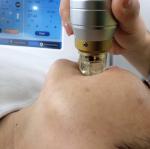 10.4'' Microneedling Fractional RF Face Lifting Skin Tightening