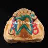 Buy cheap Cobalt Chrome Framework Ni Be Free removable dental prosthesis China Dental Lab from wholesalers