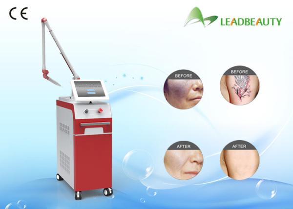 Buy cheap New product nd yag laser tattoo removal machine for removal all color tattoo from wholesalers