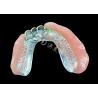 Buy cheap Enhance Your Smile Natural-looking PFM Crown bridge and Removable Dentures Combo from wholesalers