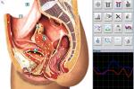 Bioresonance Health Scan and Therapy Metatron NLS 4025 Hunter for Body Detection
