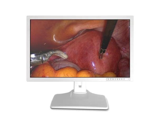 Buy cheap HDMI VGA Medical Display 32 Inch 4k Monitor from wholesalers