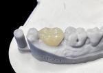 Accurate Fit Dental Ceramic Inlays Onlays , Porcelain Inlays And Onlays FDA