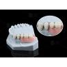 Buy cheap MK1 Attachment Dental Prosthesis Silver Partial Denture Precision Attachments from wholesalers