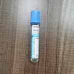 Vacuum Microbial Limited Plasma Blood Sample Tube 2ml - 5ml Light Blue Top