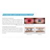 Buy cheap 0.7-0.8mm Picosecond Laser Tattoo Removal Machine Nd Yag Hydrodermabrasion from wholesalers