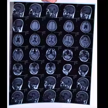 Max Density 3.0D X Ray Film 200±5μM Thick For Accurate And Detailed Medical Imaging