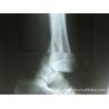 Buy cheap High Sharpness Wearable Konida Medical Imaging Xray Paper For Laser Printer from wholesalers