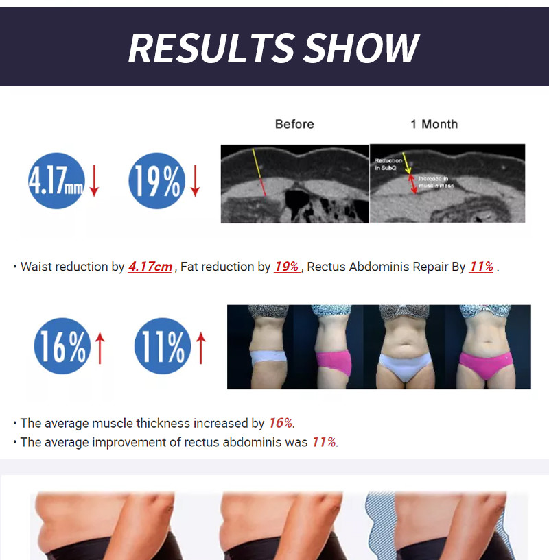 Ce 13 Tesla Ems Slim Machine , Body Sculpting Machine