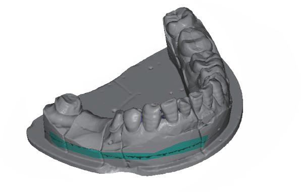 Portable blue light dental 3D scanner with 5.0 megapixel camera for dental lab desktop CAD CAM application