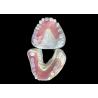 Buy cheap Valplast Flexible Partial Denture For Ultimate Comfort And Aesthetic Appeal from wholesalers