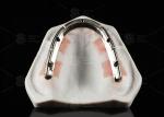 Translucent Full Contour Zirconia Bridge Over Milled Implant Bar Customized