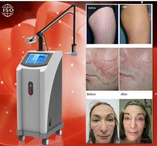 Buy cheap Fractional CO2 laser equipment / CO2 Fractional laser / Fractional CO2 laser for vaginal tightening and scar removal from wholesalers