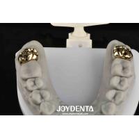 Buy cheap Oral Rehabilitation With Dental Achieve Brighter And Healthier Smile product