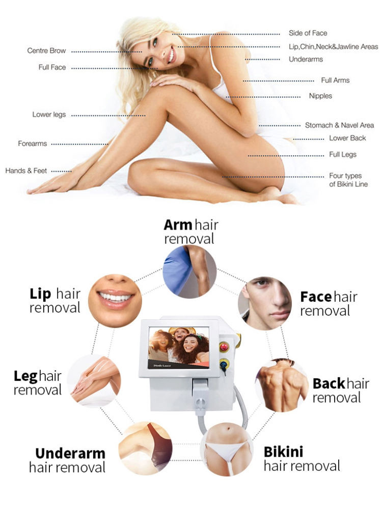 Skin Rejuvenation Diode Machine 808 Laser Full Body Laser Hair Removal Machine