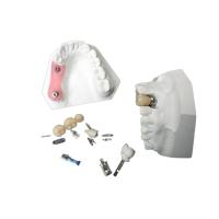 Buy cheap High Durability Zirconia Dental Implant Crown For Dental Restoration product