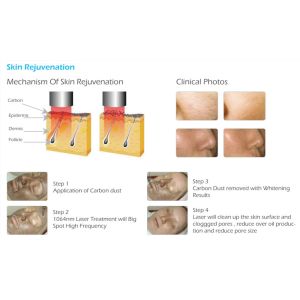 Buy cheap FDA approved Picosure Laser 755nm Professional Tattoo Removal Machine from wholesalers