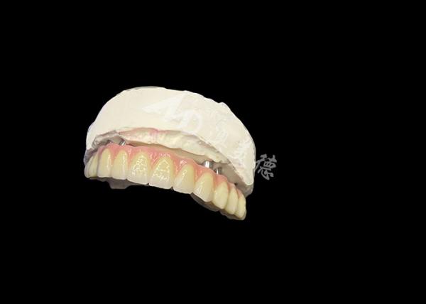 Buy cheap Implant Supported Dentures Stability Comfort and a Natural Smile from wholesalers