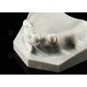 Buy cheap Biocompatibility Dental Telescope White Inner Zirconia Outer Peek Telescope Dental from wholesalers