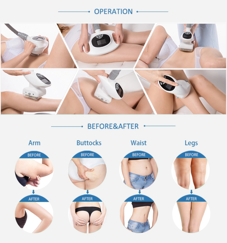 Vacuum Roller Cellulite Reduction Machine , Slimming Body Contouring Machine