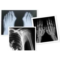 Buy cheap Thermal Digital X Ray Film Fuji Medical For Radiography Examination product