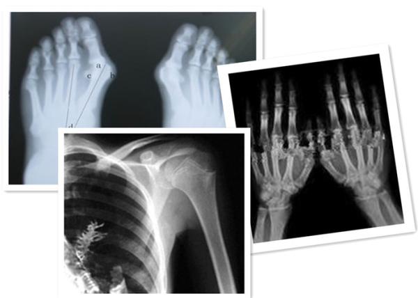 Buy cheap Thermal Digital X Ray Film Fuji Medical For Radiography Examination from wholesalers