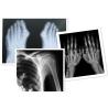 Buy cheap Thermal Digital X Ray Film Fuji Medical For Radiography Examination from wholesalers