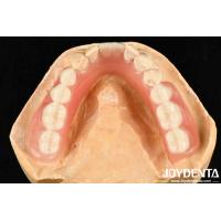 Buy cheap Diverse And Lightweight Resin Material Acrylic Denture Finish product