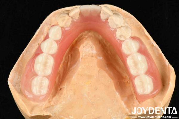 Buy cheap Diverse And Lightweight Resin Material Acrylic Denture Finish from wholesalers