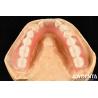 Buy cheap Diverse And Lightweight Resin Material Acrylic Denture Finish from wholesalers