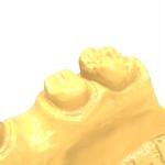 LCD Printer Rapid Cure Resin For Expedited Dental Model Repairs