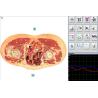 Buy cheap Health Care Products Metatron NLS Body Analyzer Herbal Treatment Equipment for Home / Hospital from wholesalers