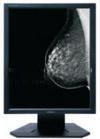 Clear picture Medical Grade Displays , 5MP Gray Scale Medical Display