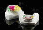 Acrylic Twin Block Orthodontic Appliance For Correcting Malocclusion