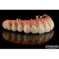 Buy cheap Custom-made For Each Patient Ti-Bar Zirconia Hybrid Bridge For Long-lasting product